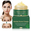 OEM Custom Herbal Acne Scar Removal Brightening Cream